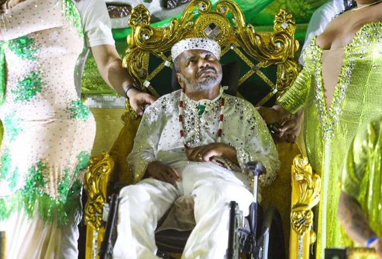Arlindo Cruz é internado no Rio com pneumonia